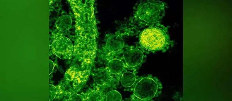 Karnataka Issues Advisory Amid Nipah Scare