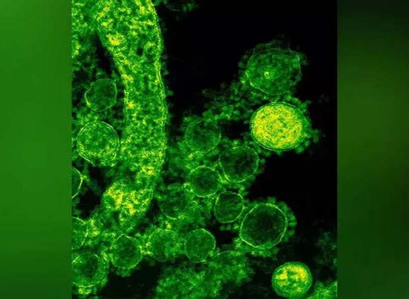 Karnataka Issues Advisory Amid Nipah Scare